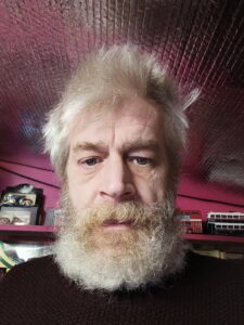 Jimmy Plays with long hair